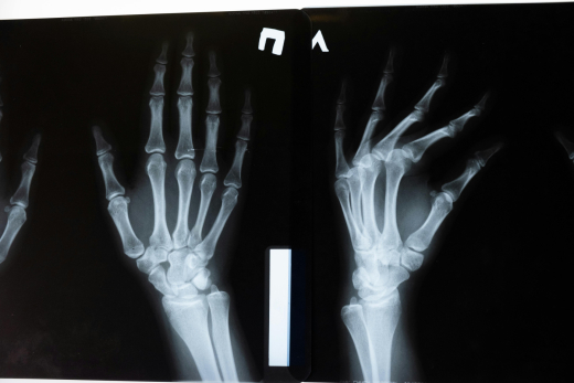 Hand & Wrist Orthopedics