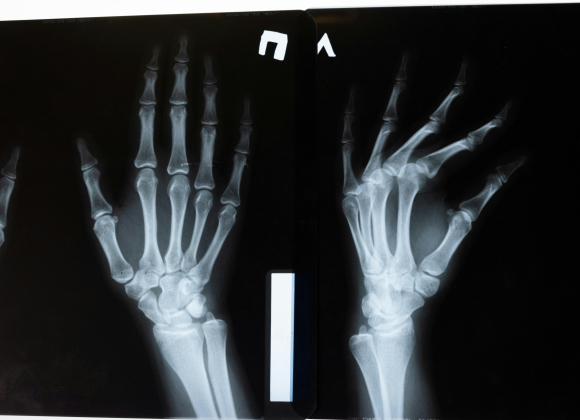 Hand & Wrist Orthopedics